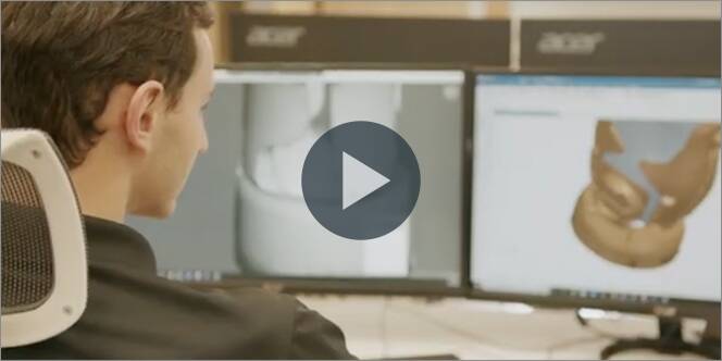 Unlimited Tomorrow Lowers Cost of Prostheses by 90% with Siemens and AWS